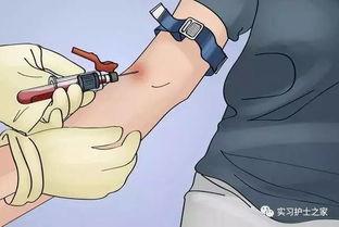 静脉采血操作视频,步骤与技巧全解析
