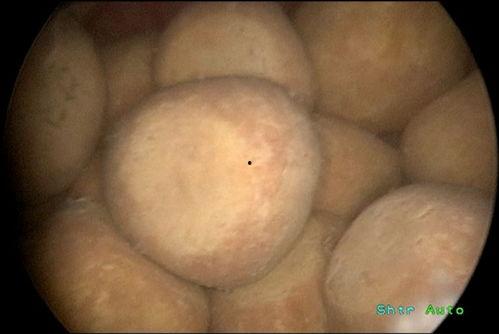 膀胱视频,视频揭示人体泌尿系统秘密