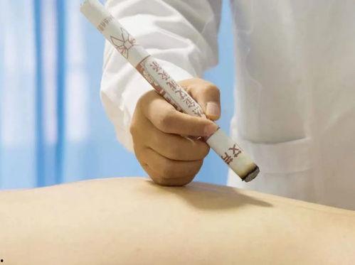 刮痧拔罐视频,健康生活新体验——揭秘刮痧拔罐神奇功效