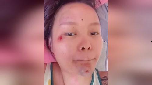 吃瓜爆料下巴变尖的女生,神秘美女下巴变尖，颜值飙升引关注