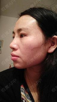 吃瓜爆料下巴变尖的女生,神秘美女下巴变尖，颜值飙升引关注